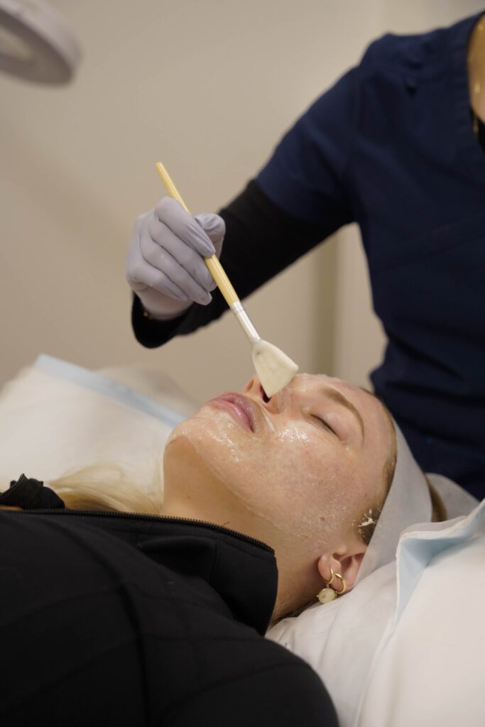 Chemical Peels Melbourne Williamstown