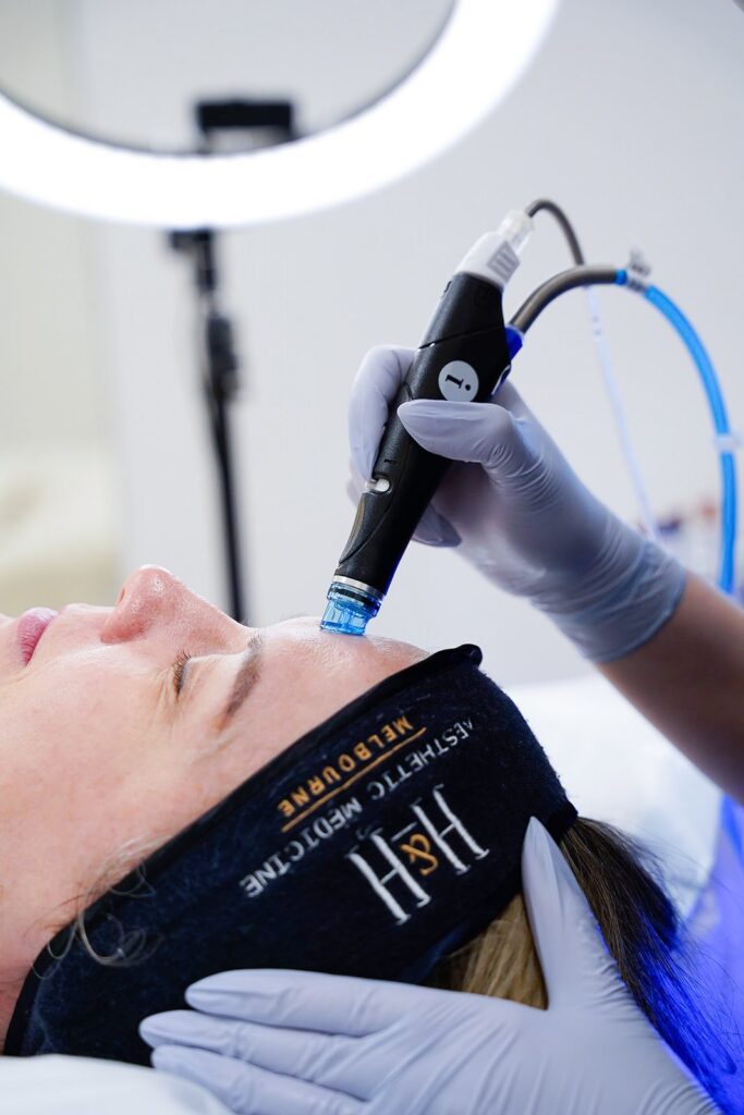 HydraFacial Melbourne Williamstown Skin Health Treatment