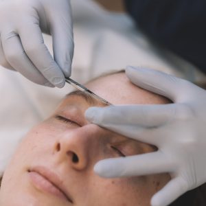 Epidermal Levelling